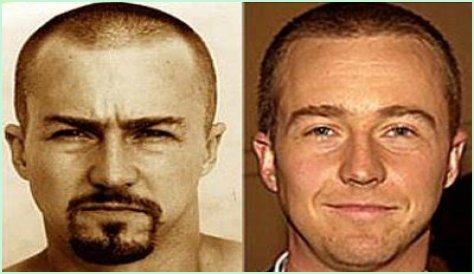 Edward Norton Plastic Surgery Before and After